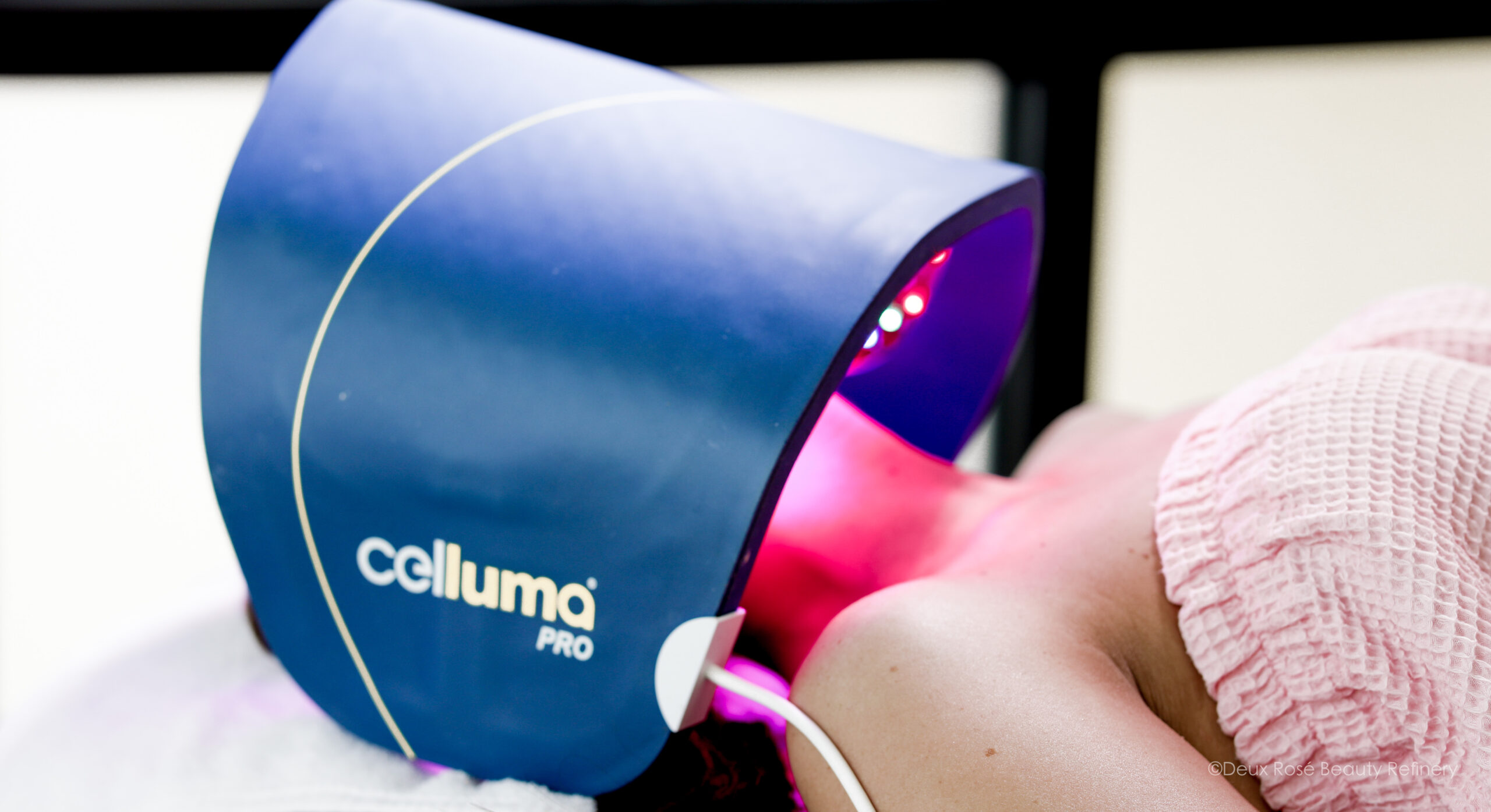 Struggling with Rosacea?